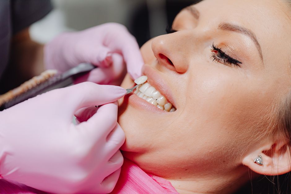 Implantul Dentar: O Soluție Modernă pentru Restaurarea Zâmbetului și a Sănătății Orale